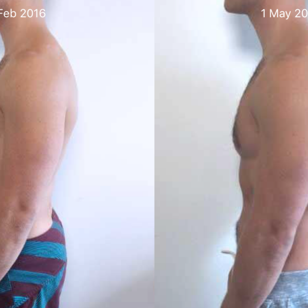 before-and-after-example-side-view